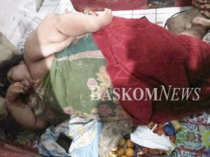 Tak Kontrol Makan Mie Instan dan Cemilan, Berat Badan Narti sampai 250 Kg