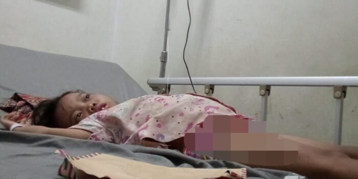 Meida Putri dari Karawang Alami Sakit Kondisi Orangtua Tidak Mampu Butuh Perhatian Dermawan